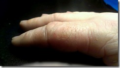 dry finger